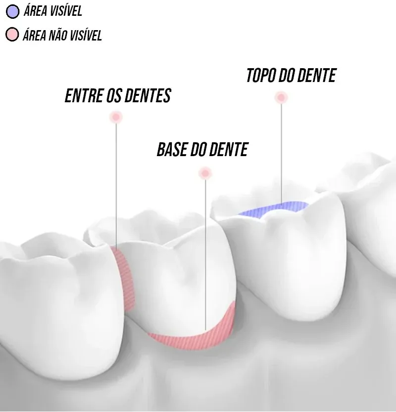 Irrigador Oral Portátil 200ml com 5 Bicos USB