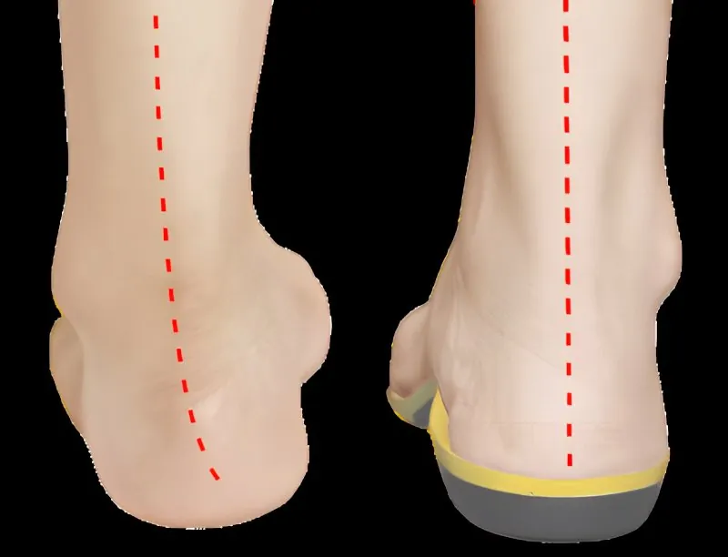 Palmilha de Gel Confortável com Amortecimento para Calçados