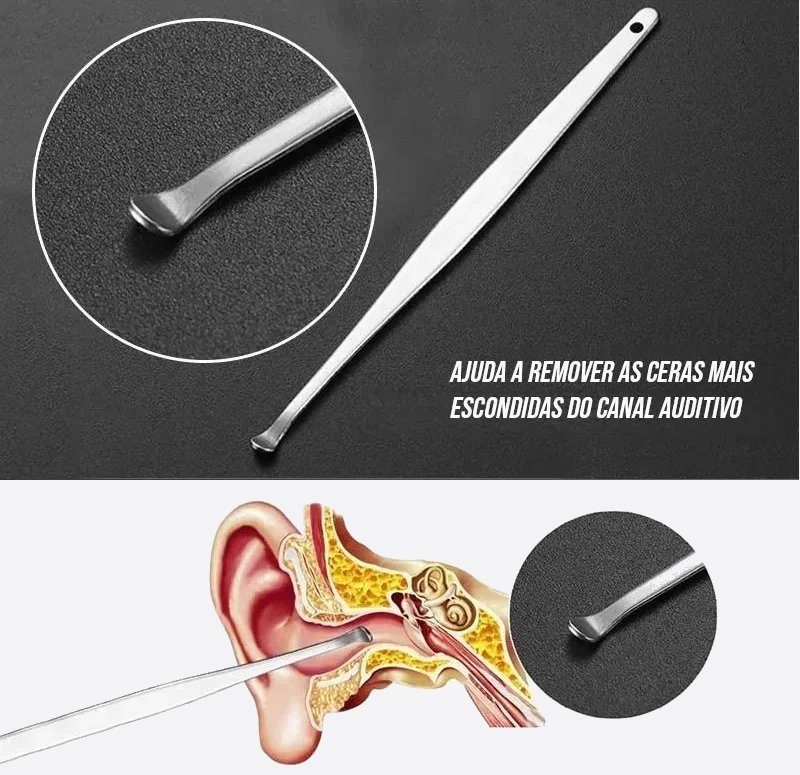 Kit Removedor de Cera de Ouvido com 6 Peças Inox